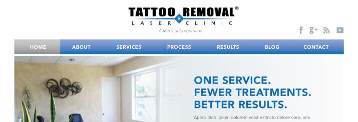 Tattoo-Removal-Website